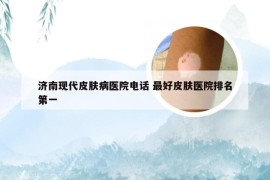 济南现代皮肤病医院电话 最好皮肤医院排名第一