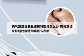 天气潮湿皮肤起疙瘩特别痒怎么办 天气潮湿皮肤起疙瘩特别痒怎么办啊