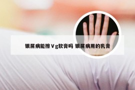 银屑病能擦Ⅴg软膏吗 银屑病用的乳膏