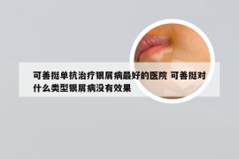 可善挺单抗治疗银屑病最好的医院 可善挺对什么类型银屑病没有效果