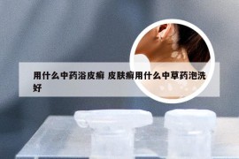 用什么中药浴皮癣 皮肤癣用什么中草药泡洗好