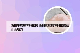 洛阳牛皮癣专科医院 洛阳皮肤病专科医院在什么地方