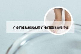 广安门皮肤科怎么样 广安门医院皮科门诊