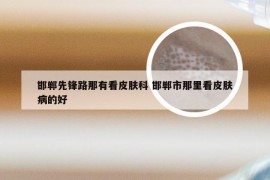 邯郸先锋路那有看皮肤科 邯郸市那里看皮肤病的好