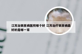 江苏治银屑病医院哪个好 江苏治疗银屑病最好的是哪一家