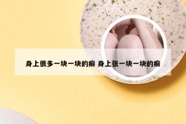 身上很多一块一块的癣 身上张一块一块的癣