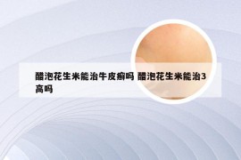 醋泡花生米能治牛皮癣吗 醋泡花生米能治3高吗