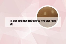 小柴胡加姜附汤治疗银屑病 小柴胡汤 银屑病