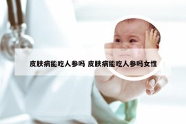 皮肤病能吃人参吗 皮肤病能吃人参吗女性