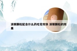 消银颗粒配合什么药吃见效快 消银颗粒的效果