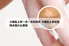 小腿肚上有一点一点白斑点 小腿肚上有白色斑点是什么原因