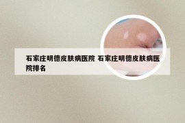 石家庄明德皮肤病医院 石家庄明德皮肤病医院排名