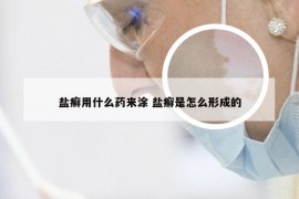 盐癣用什么药来涂 盐癣是怎么形成的