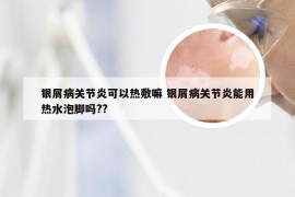 银屑病关节炎可以热敷嘛 银屑病关节炎能用热水泡脚吗??