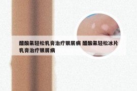醋酸氟轻松乳膏治疗银屑病 醋酸氟轻松冰片乳膏治疗银屑病