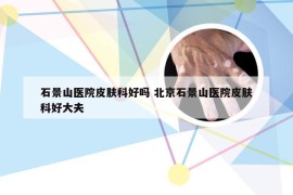 石景山医院皮肤科好吗 北京石景山医院皮肤科好大夫