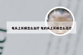 龟头上长癣怎么治疗 龟的头上长癣怎么治疗