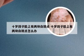 十岁孩子脸上有两块白斑点 十岁孩子脸上有两块白斑点怎么办