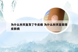 为什么秋天复发了牛皮癣 为什么秋天容易得皮肤病