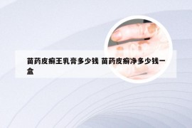 苗药皮癣王乳膏多少钱 苗药皮癣净多少钱一盒