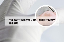 牛皮癣治疗仪哪个牌子最好 保健治疗仪哪个牌子最好