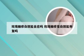 玫瑰糠疹白斑能自愈吗 玫瑰糠疹变白斑能恢复吗