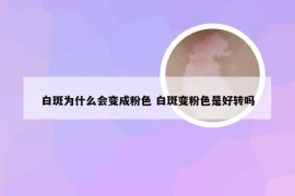 白斑为什么会变成粉色 白斑变粉色是好转吗