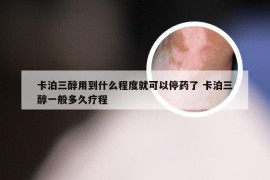 卡泊三醇用到什么程度就可以停药了 卡泊三醇一般多久疗程