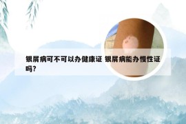 银屑病可不可以办健康证 银屑病能办慢性证吗?