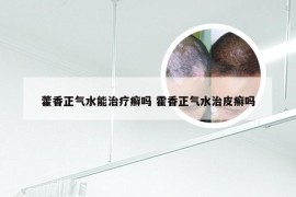 藿香正气水能治疗癣吗 霍香正气水治皮癣吗