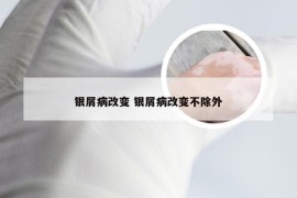 银屑病改变 银屑病改变不除外