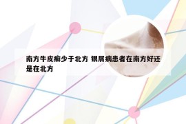 南方牛皮癣少于北方 银屑病患者在南方好还是在北方
