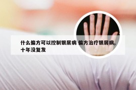 什么偏方可以控制银屑病 偏方治疗银屑病,十年没复发