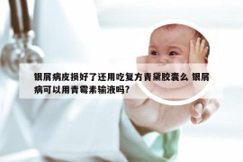银屑病皮损好了还用吃复方青黛胶囊么 银屑病可以用青霉素输液吗?