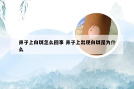 鼻子上白斑怎么回事 鼻子上出现白斑是为什么
