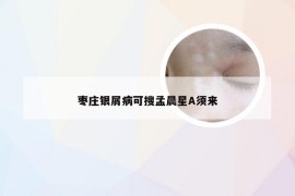 枣庄银屑病可搜孟晨星A须来