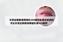 石家庄联勤保障部队980医院能看皮肤病吗 河北石家庄联勤保障部队第980医院