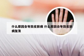 什么原因会导致皮肤病 什么原因会导致皮肤病复发