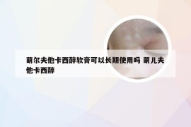 萌尔夫他卡西醇软膏可以长期使用吗 萌儿夫他卡西醇