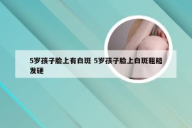 5岁孩子脸上有白斑 5岁孩子脸上白斑粗糙发硬