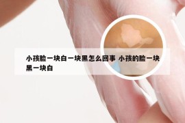 小孩脸一块白一块黑怎么回事 小孩的脸一块黑一块白