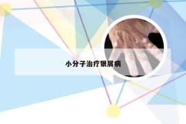 小分子治疗银屑病