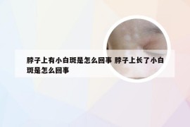 脖子上有小白斑是怎么回事 脖子上长了小白斑是怎么回事