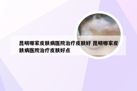 昆明哪家皮肤病医院治疗皮肤好 昆明哪家皮肤病医院治疗皮肤好点