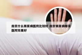南京什么银屑病医院比较好 南京银屑病哪家医院效果好