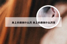 身上长癣抹什么药 身上长癣抹什么药膏