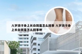 八岁孩子身上长白斑是怎么回事 八岁孩子身上长白斑是怎么回事啊