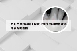 苏州市皮肤科哪个医院比较好 苏州市皮肤科比较好的医院