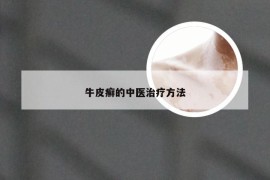 牛皮癣的中医治疗方法