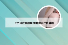 土方治疗银翘病 银翘散治疗银屑病